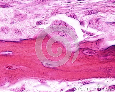 Osteoclast. Howshipâ€™s lacuna Stock Photo